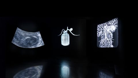 Ulisse: ECHO scan slide bottle